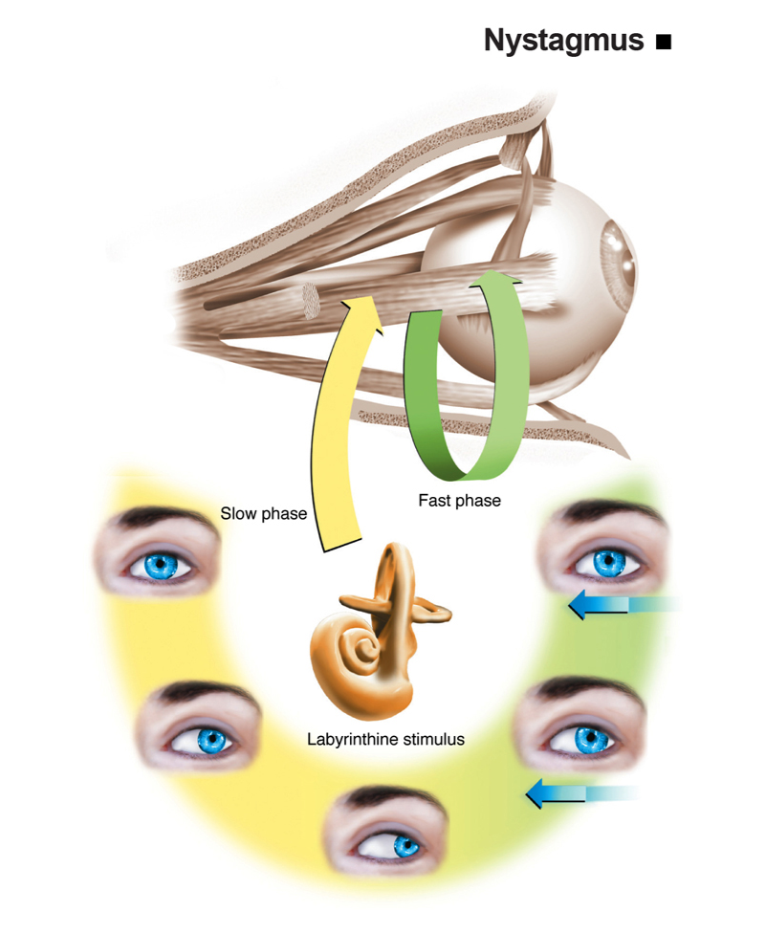 Infografis nystagmus